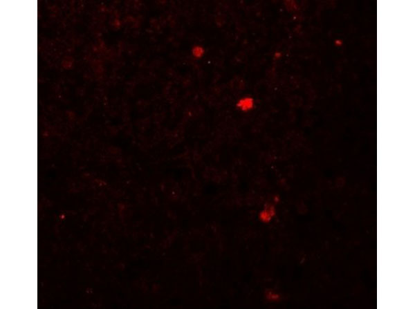 Immunofluorescence of LAMTOR2