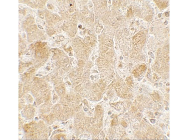 Immunohistochemistry of LAMTOR2