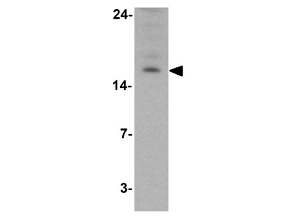 Western blot of LAMTOR2