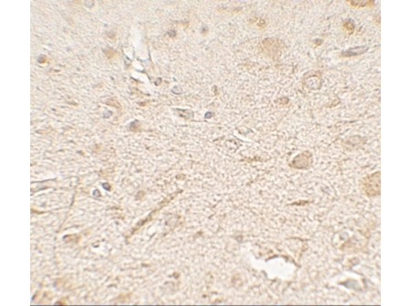 Immunohistochemistry of LAMTOR3