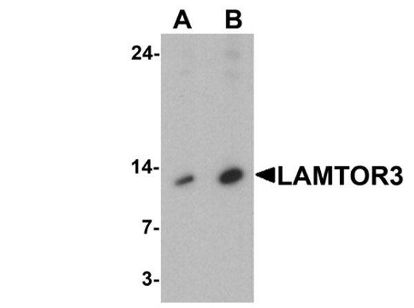 Western blot of LAMTOR3