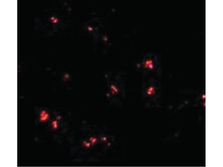 Immunofluorescence of LASS5 Antibody