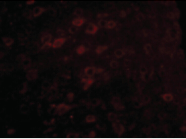 Immunofluorescence of LASS6 Antibody