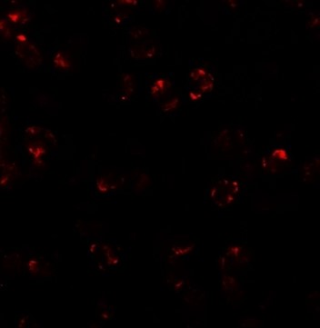 Immunofluorescence of LEMD2