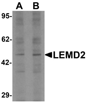Western blot analysis of LEMD2