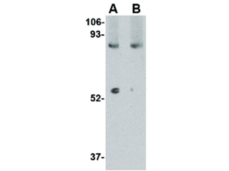 Western Blot of LGI1 Antibody