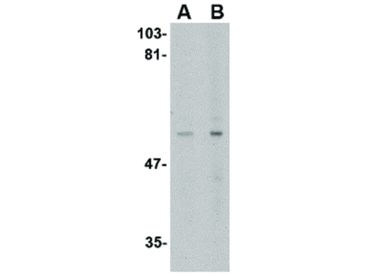 Western Blot of LGI4 Antibody