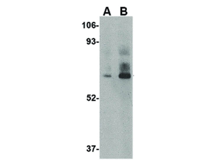 Western Blot of LGP2 Antibody