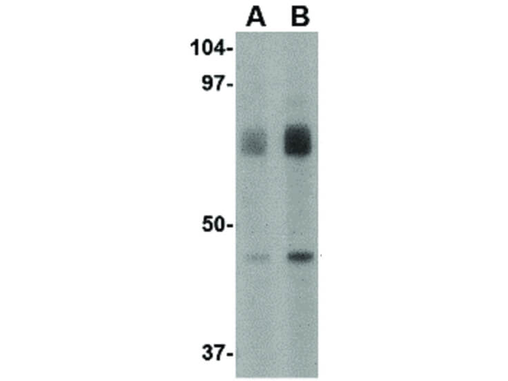 Western Blot of LGP2 Antibody