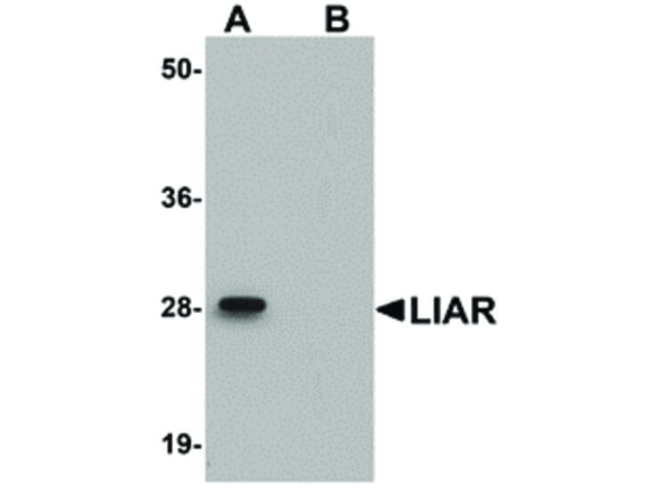 Western Blot of LIAR Antibody
