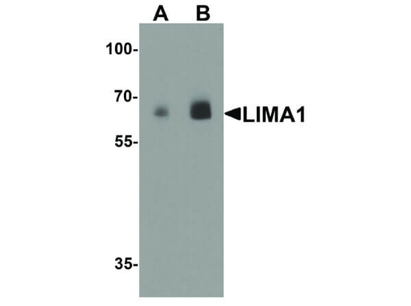Western Blot of LIMA1 Antibody