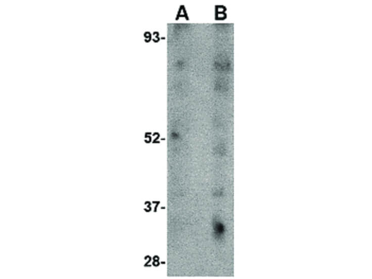 Western Blot of LIMP2 Antibody