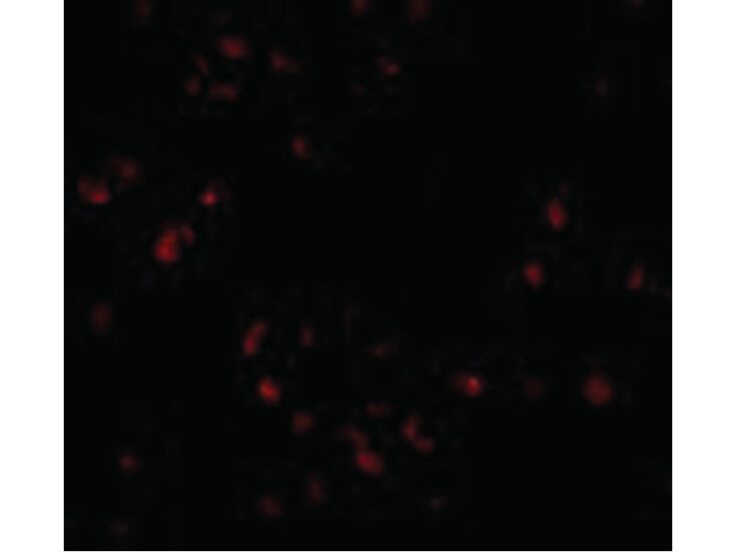 Immunofluorescence of LIS1 Antibody