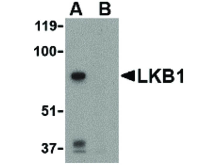 Western Blot of LKB1 Antibody