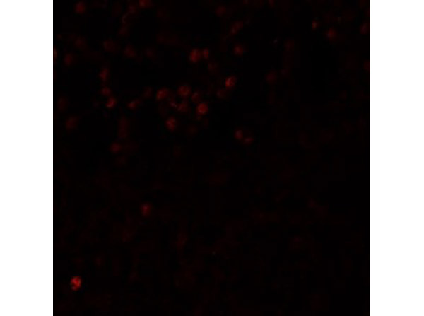 Immunofluorescence of LMBRD1