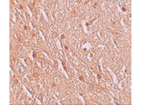 Immunohistochemistry of LMBRD1