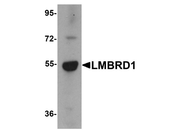 Western blot analysis of LMBRD1