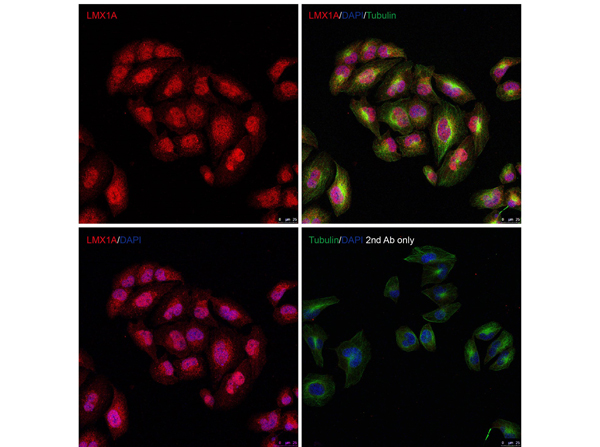 Immunofluorescence of LMX1A