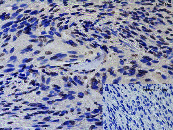 Immunohistochemistry of LMX1A