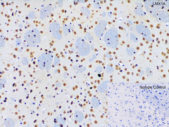Immunohistochemistry of LMX1A