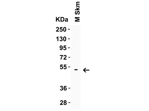Western Blot of LMX1A