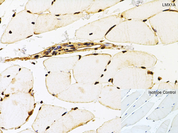 Immunohistochemistry of LMX1A