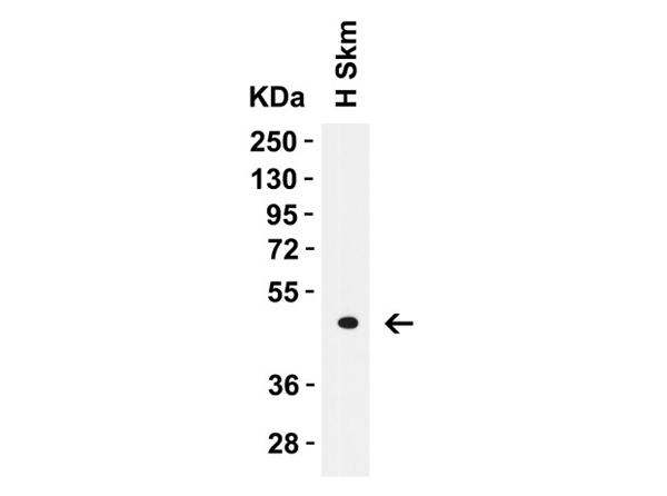 Western Blot of LMX1A