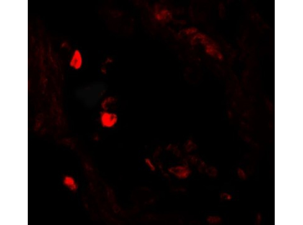 Immunofluorescence of LNPEP