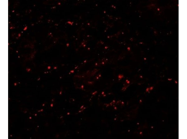Immunofluorescence of LPIN1