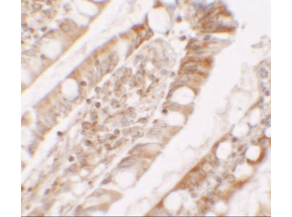 Immunohistochemistry of LPIN1