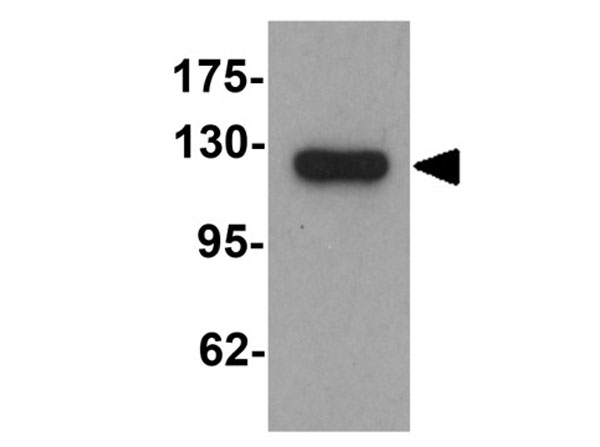 Western blot of LPIN1