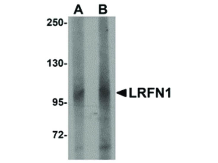 Western Blot of LRFN1 Antibody