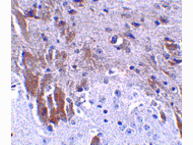 Immunohistochemistry of LRFN1 Antibody