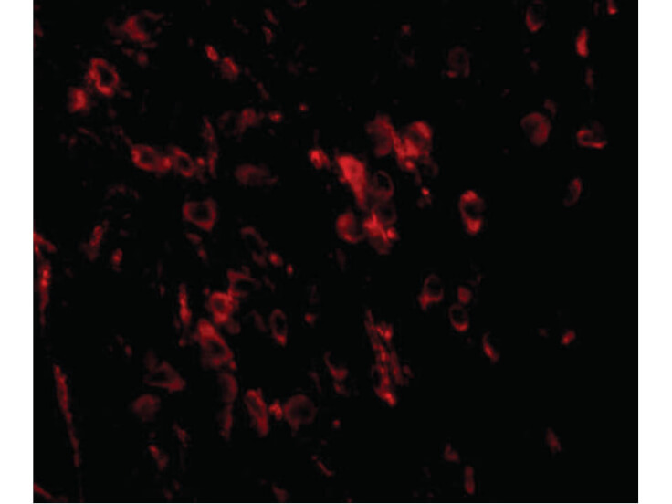 Immunofluorescence of LRFN1 Antibody