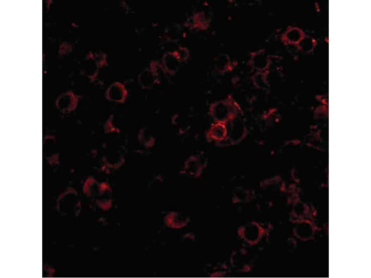 Immunofluorescence of LRFN2 Antibody