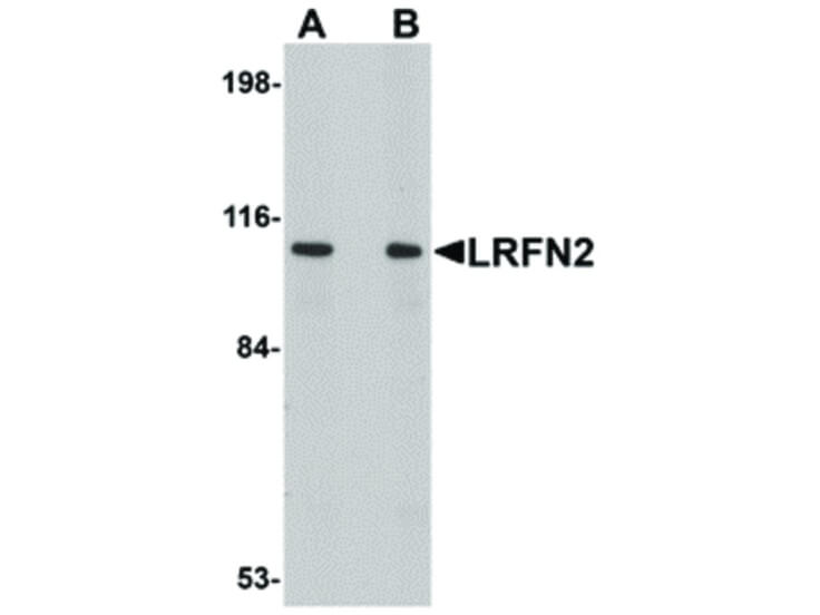 Western Blot of LRFN2 Antibody