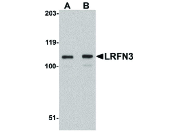 Western Blot of LRFN3 Antibody
