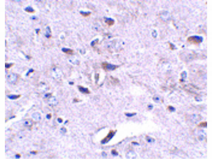 Immunohistochemistry of LRFN3 Antibody