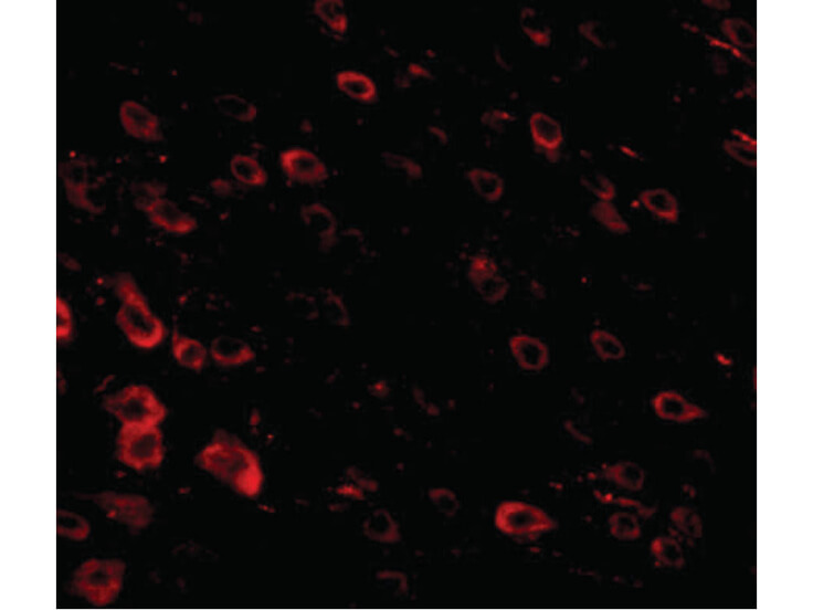 Immunofluorescence of LRFN3 Antibody