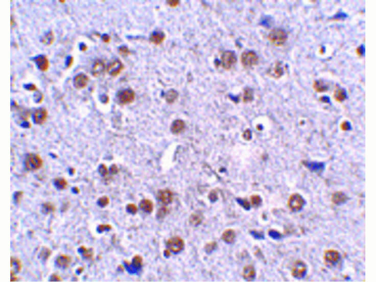 Immunohistochemistry of LRFN4 Antibody