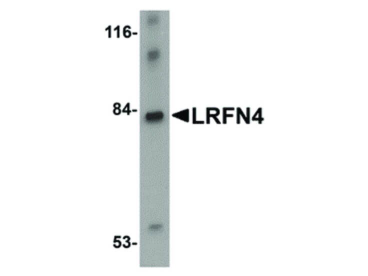 Western Blot of LRFN4 Antibody