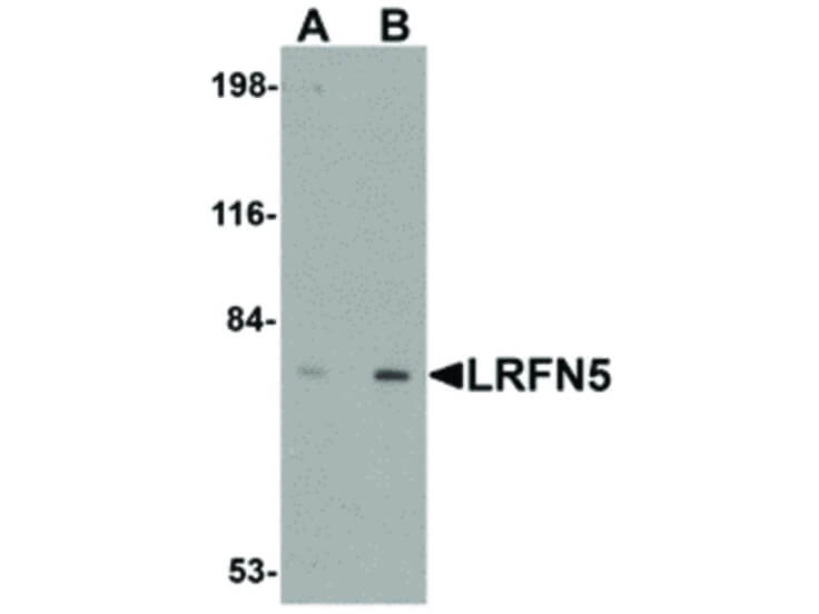 Western Blot of LRFN5 Antibody