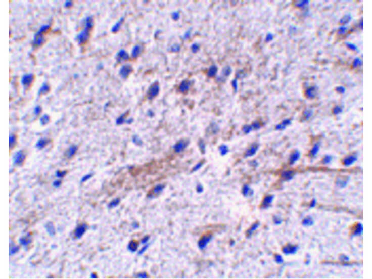 Immunohistochemistry of LRFN5 Antibody