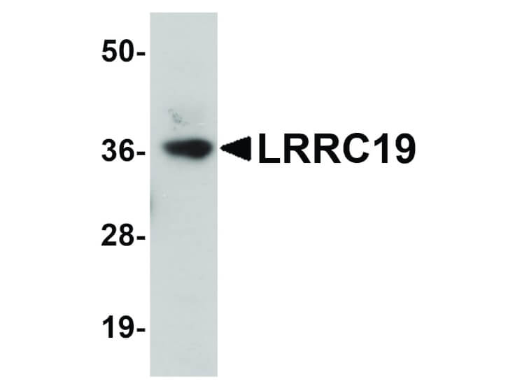 Western Blot of LRRC19 Antibody