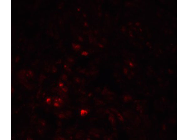 Immunofluorescence of LRRC26