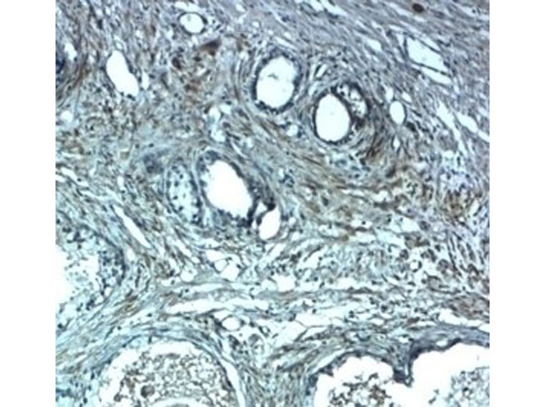 Immunohistochemistry of LRRC26