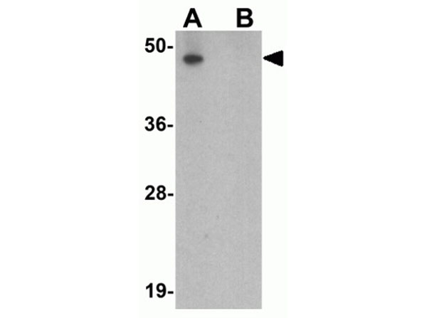Western blot of LRRC26