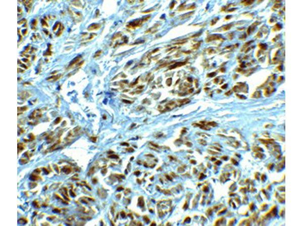 Immunohistochemistry of LRRC26