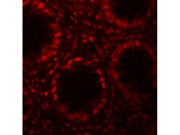 Immunofluorescence of LRRFIP1