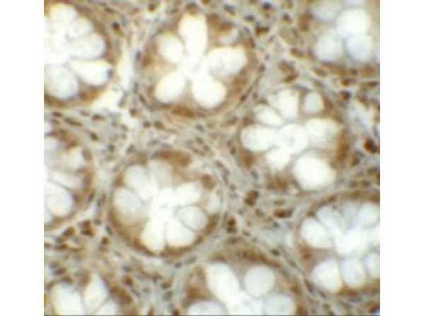 Immunohistochemistry of LRRFIP1